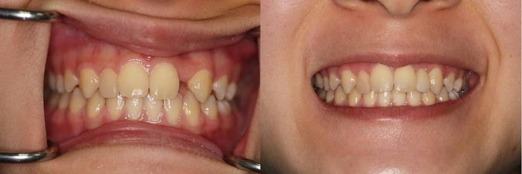 Malo Dental Prosthodontics | 2525 Embassy Dr #1, Hollywood, FL 33026 | Phone: (954) 430-3444