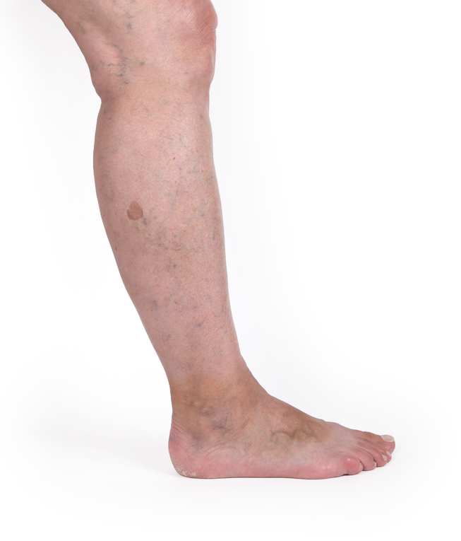 Dr. Scott C. Hollander, DO | 4622 E Black Horse Pike Ste 102, Mays Landing, NJ 08330, USA | Phone: (609) 829-3285