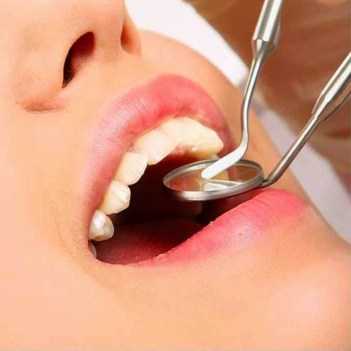 Rosemead Dental Group | 6654 Rosemead Blvd, Pico Rivera, CA 90660, USA | Phone: (562) 222-2833