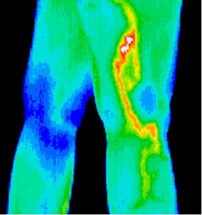 East Valley Thermography | 16815 S Desert Foothills Pkwy Suite 119, Phoenix, AZ 85048, USA | Phone: (602) 730-1644