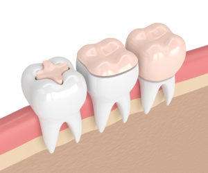 Tilger Center for Dentistry | 938 Gemini Ave, Houston, TX 77058, USA | Phone: (281) 480-6600