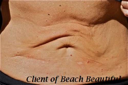 Beach Beautiful | 1929 Voorhees Ave. A-1, Redondo Beach, CA 90278 | Phone: (818) 796-3880