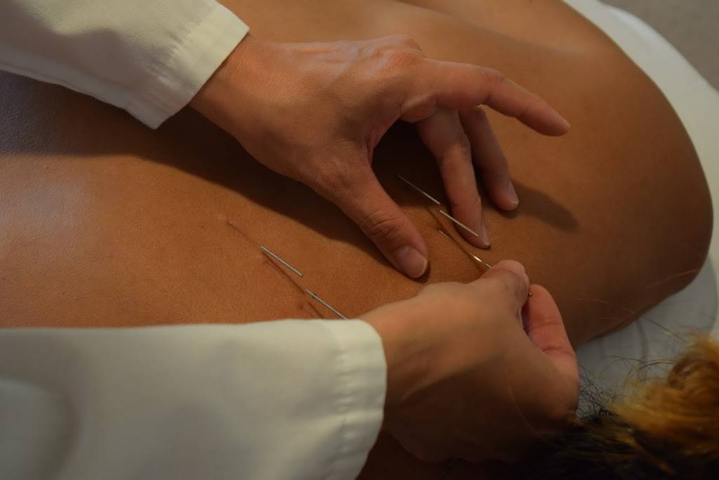 Raven Acupuncture Clinic | 1961 Pruneridge Ave, Santa Clara, CA 95050, USA | Phone: (408) 758-2881