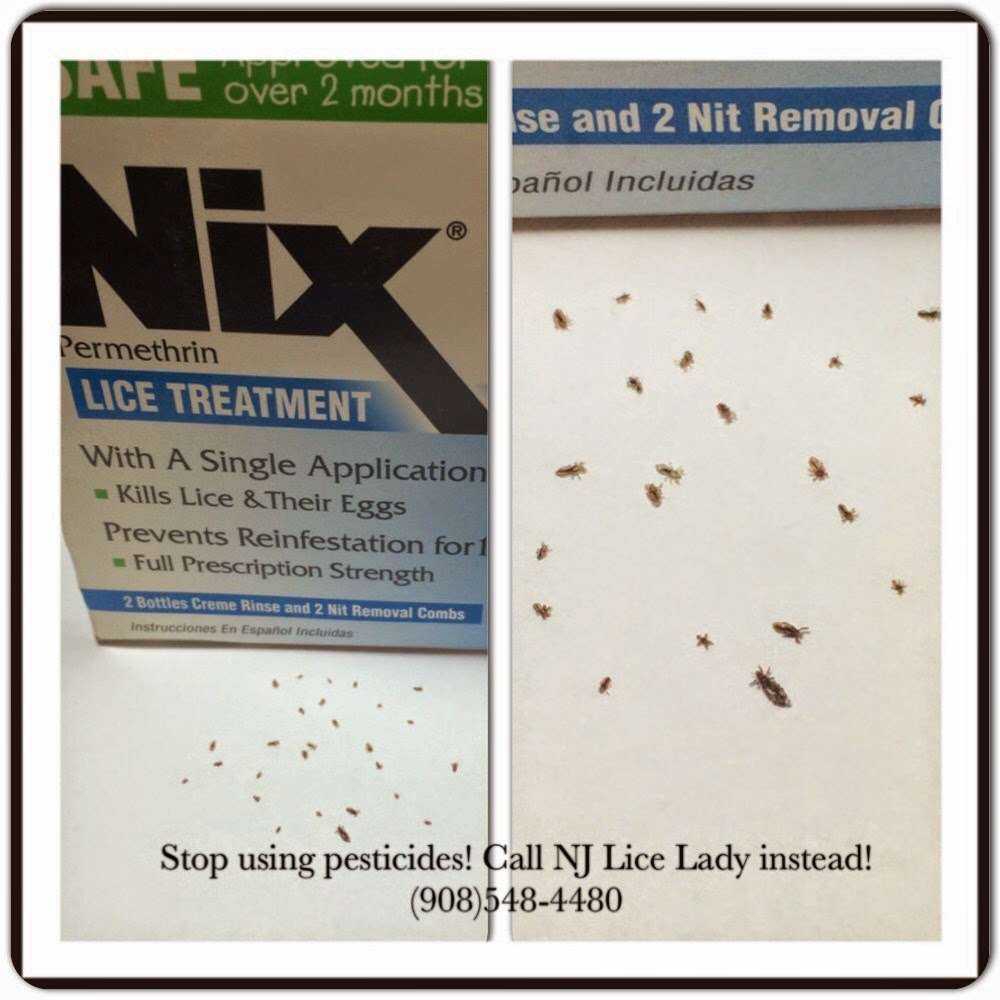 NJ Lice Lady | 1245 Sunnyfield Ln, Scotch Plains, NJ 07076 | Phone: (908) 548-4480