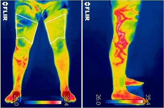 Thermography of Crosby | 118 Kernohan St, Crosby, TX 77532, USA | Phone: (281) 886-8801