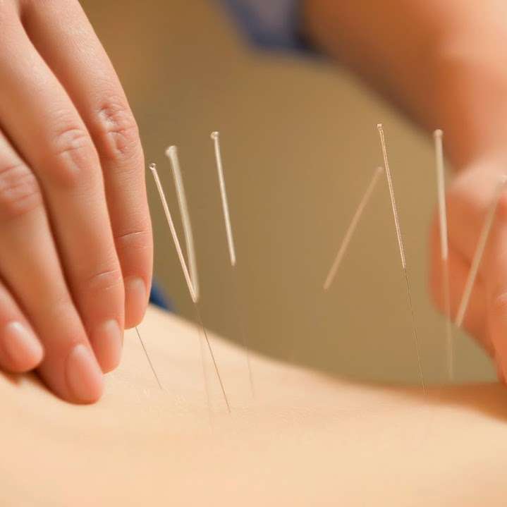 Won Institute of Graduate Studies Acupuncture Clinics | 137 S Easton Rd, Glenside, PA 19038, USA | Phone: (215) 884-8942