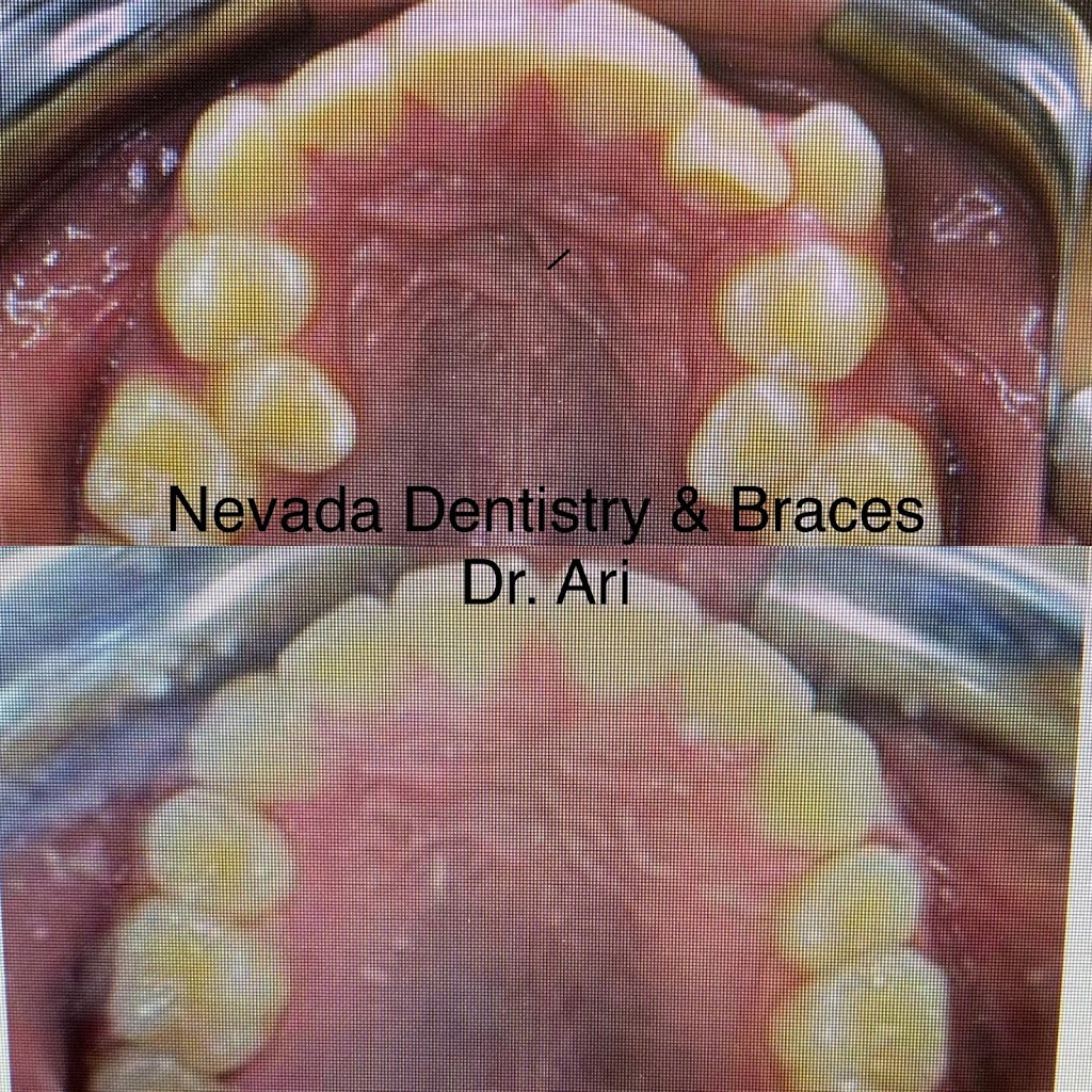 Nevada Dentistry & Braces | 4492 S Pecos Rd, Las Vegas, NV 89121, USA | Phone: (702) 701-7999