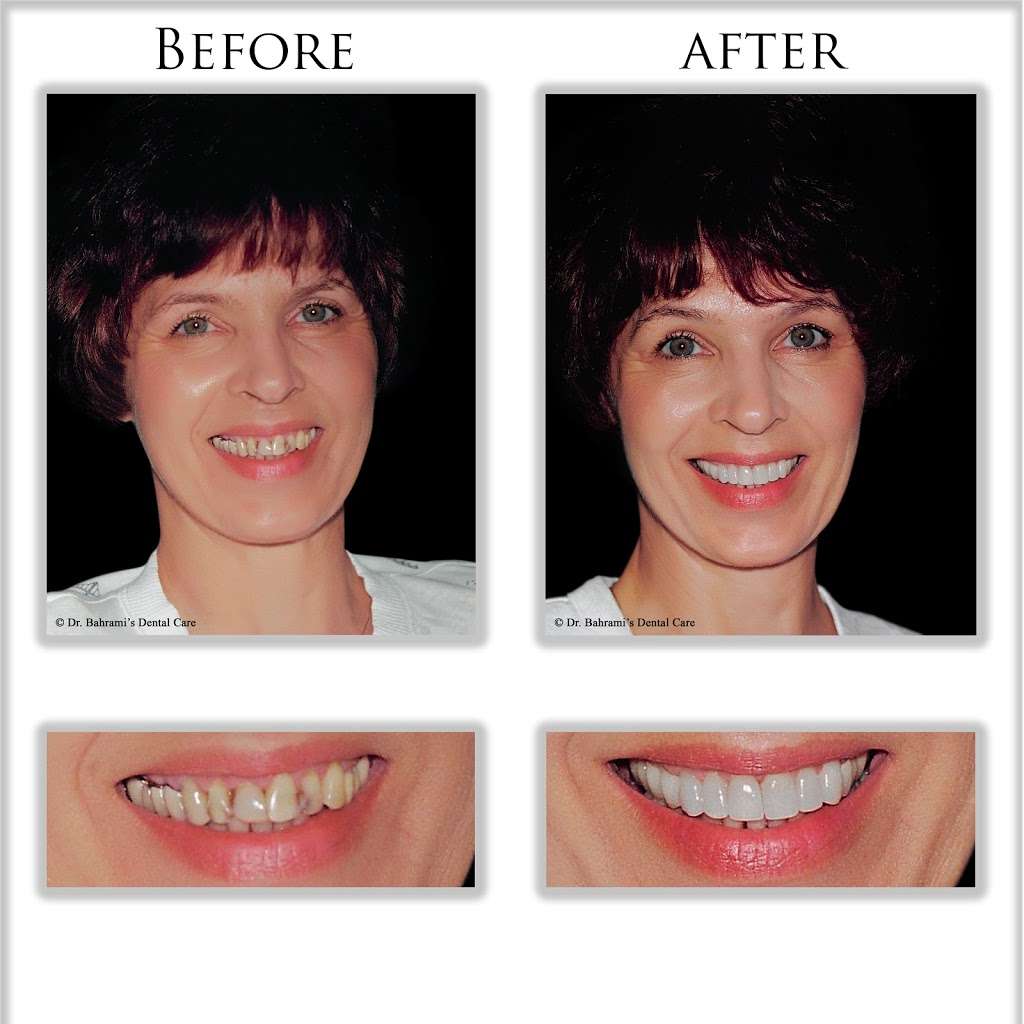Dr. Bahramis Dental Care | 11444 W Washington Blvd, Los Angeles, CA 90066, USA | Phone: (310) 398-9800