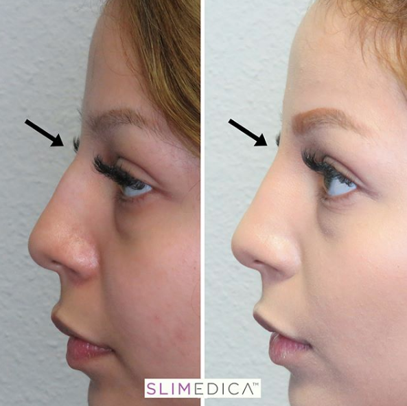 SliMedica | 14615 San Pedro Ave #120, San Antonio, TX 78232, USA | Phone: (210) 971-4000