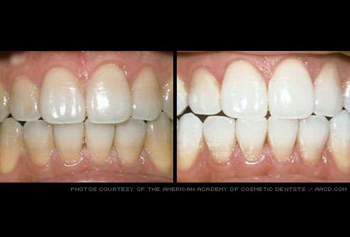 Dentistry For You-19th Ave | 5501 N 19th Ave #206, Phoenix, AZ 85015, USA | Phone: (602) 249-4465