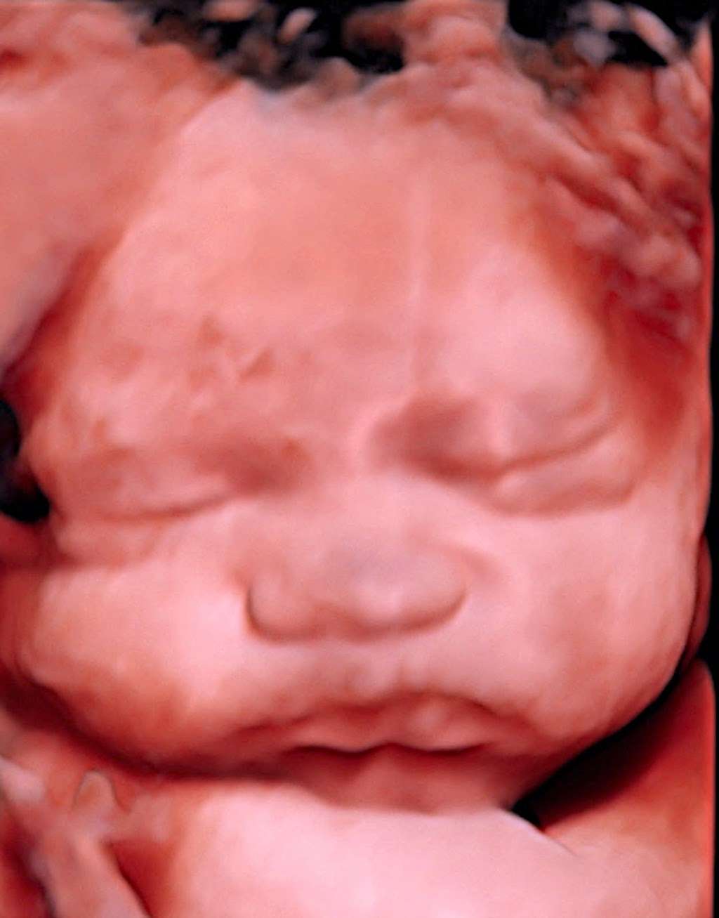 Your 4D Baby - 3D 4D Ultrasound Miami | 10550 NW 77th Ct #111, Hialeah Gardens, FL 33016, USA | Phone: (305) 200-5366