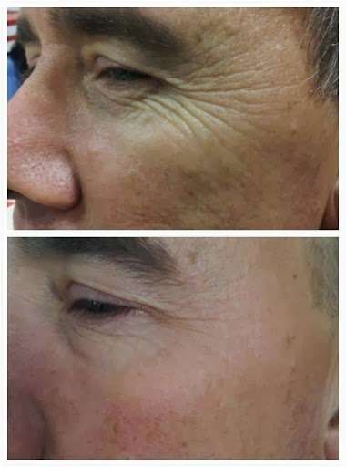 Amazing Skin | 13 Oakland Rd, Pepperell, MA 01463, USA | Phone: (978) 877-0972