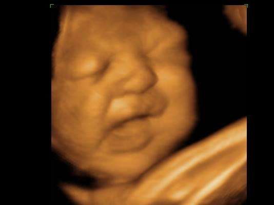Belly 2 Birth | 1131 NJ-31 STE B, Lebanon, NJ 08833, USA | Phone: (908) 655-2939