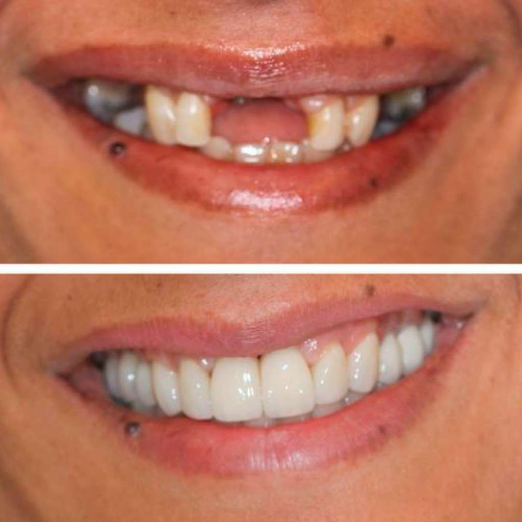 Revitta Smile | 133-A West End Ave, Brooklyn, NY 11235 | Phone: (212) 535-1202