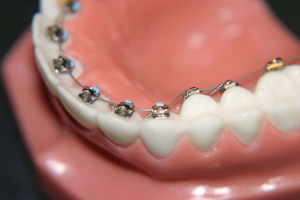 Santelli Orthodontics | 3319 FL-7 #211, Wellington, FL 33449, USA | Phone: (561) 395-6464