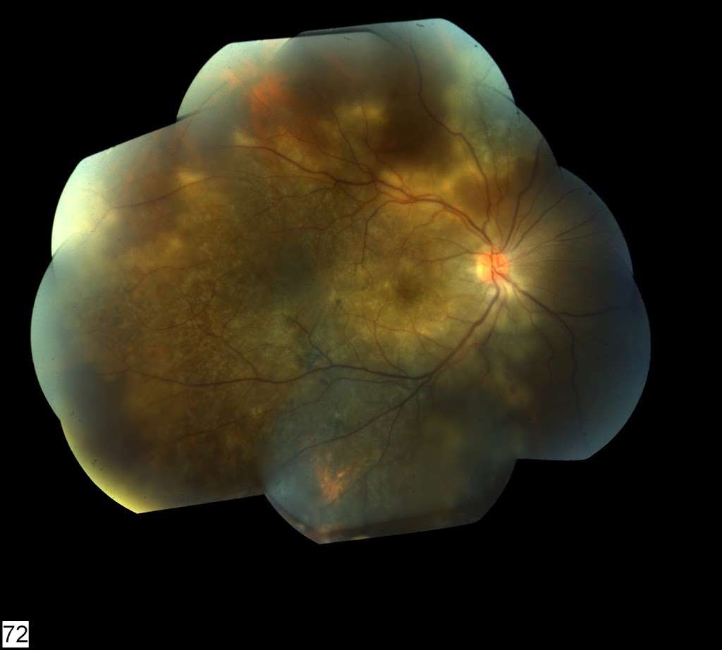 Richard Press Ophthalmic Imaging | 70 Clarken Dr, West Orange, NJ 07052, USA | Phone: (973) 715-6007