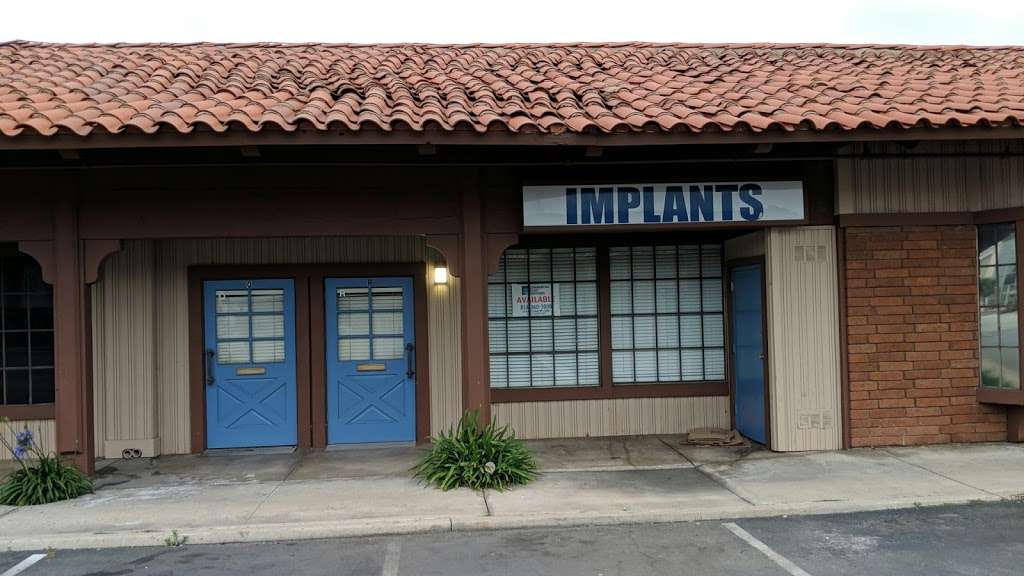 Implants | El Cajon, CA 92020