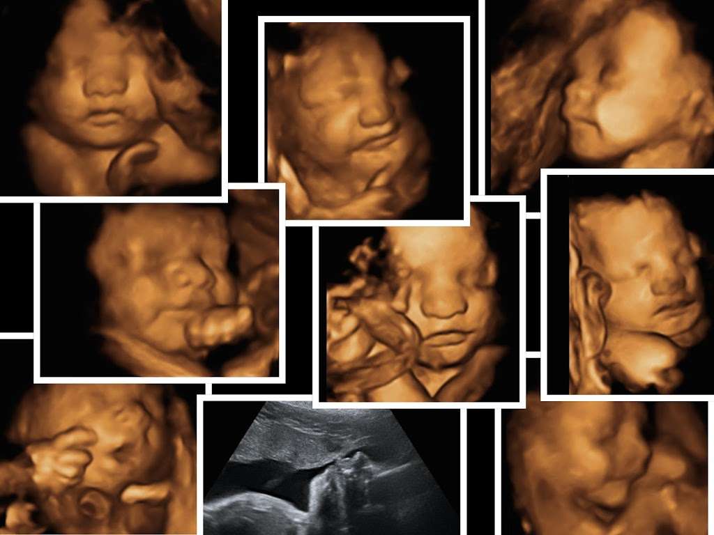 My Sweet Baby 3D/4D Ultrasounds | 5530 25th St, Columbus, IN 47203 | Phone: (812) 260-1881