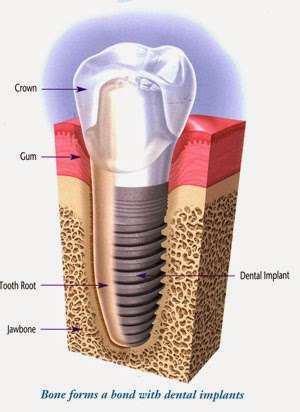 Broomall Dental Health: Watson Thomas C DDS | 39 N Sproul Rd, Broomall, PA 19008 | Phone: (610) 356-8011