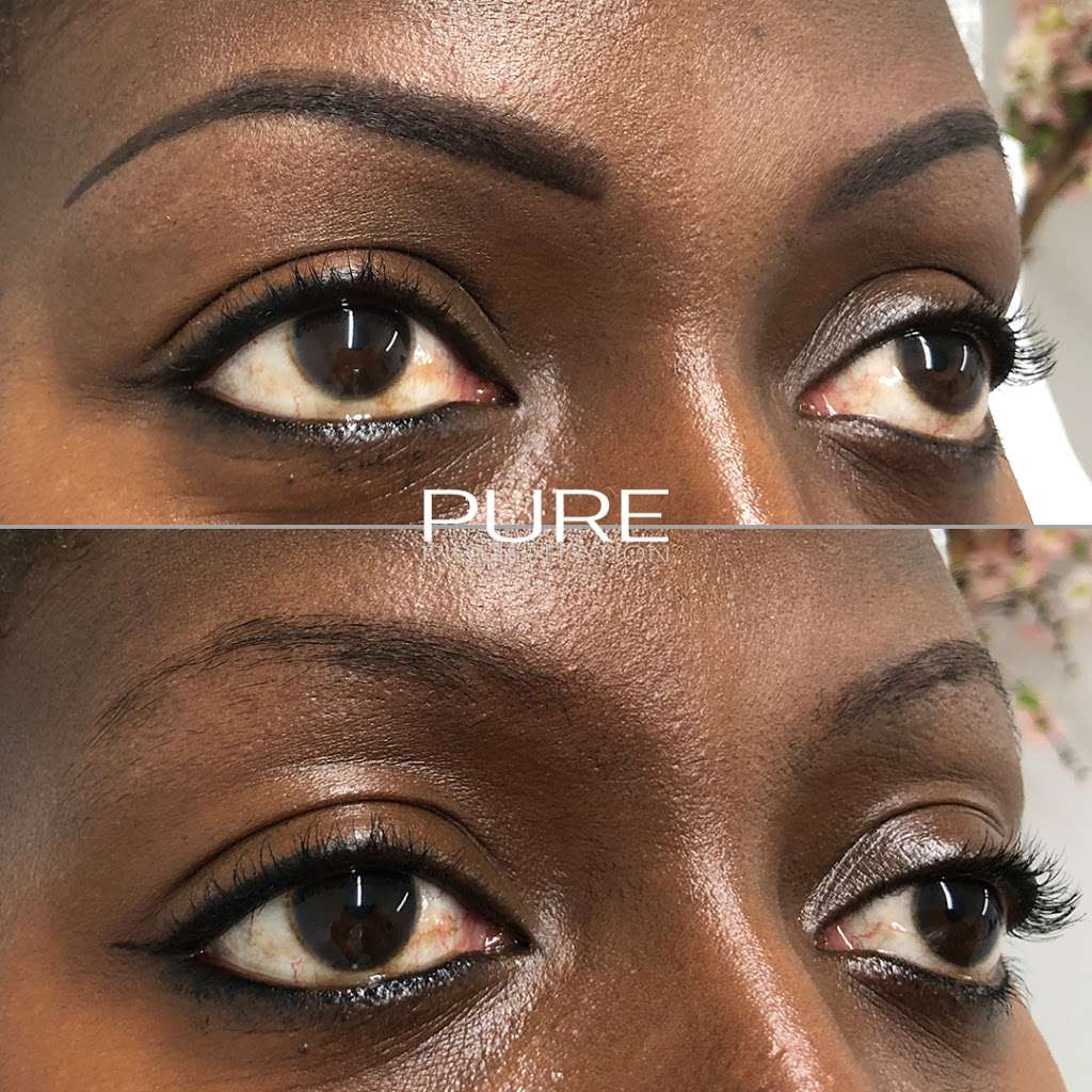 Pure Pigmentation | 9 Fenemore Rd, Caterham, Kenley CR8 5GJ, UK | Phone: 0845 643 1233