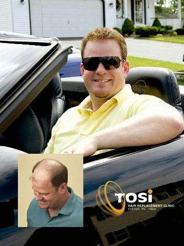 Tosis Hair Replacement Clinic | 390 Slocum Ave, Exeter, PA 18643, USA | Phone: (570) 693-3276