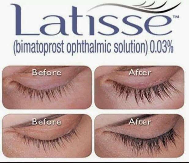 Skin Aesthetics Medical Spa | 2801 N Walnut St, Bloomington, IN 47404, USA | Phone: (812) 327-1167