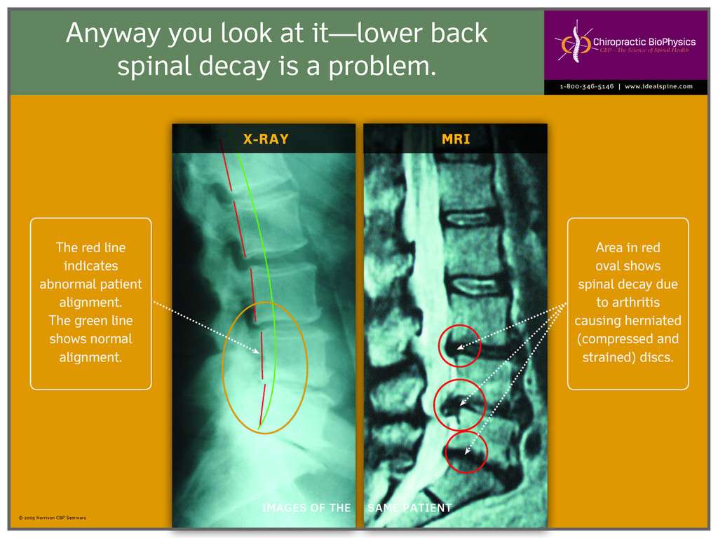 ADIOS Chiropractic, PC | 2500 Lemoine Ave #303, Fort Lee, NJ 07024, USA | Phone: (201) 363-0233