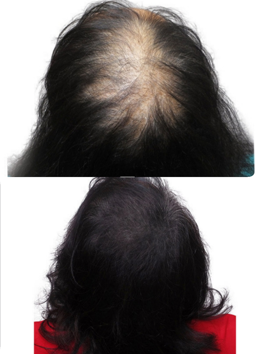 Pro Scalp Pigmentation | 18701 Curry Powder Ln, Germantown, MD 20874 | Phone: (301) 969-8850