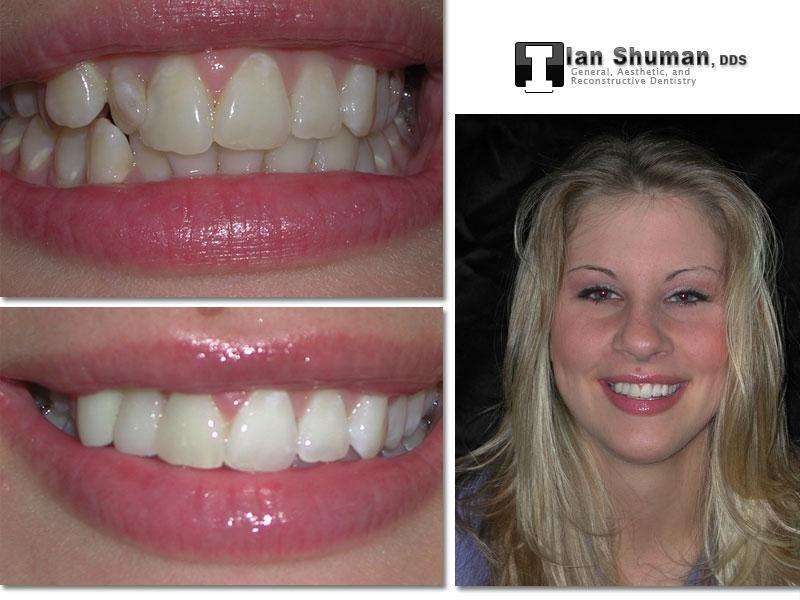 Dr. Ian Shuman, DDS | 8028 Ritchie Hwy Suite 306, Pasadena, MD 21122, USA | Phone: (410) 766-5104