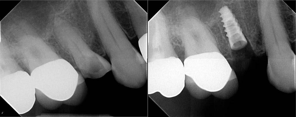 Ruban Family and Cosmetic Dentistry | 4312 W El Prado Blvd, Tampa, FL 33629, USA | Phone: (813) 831-8588