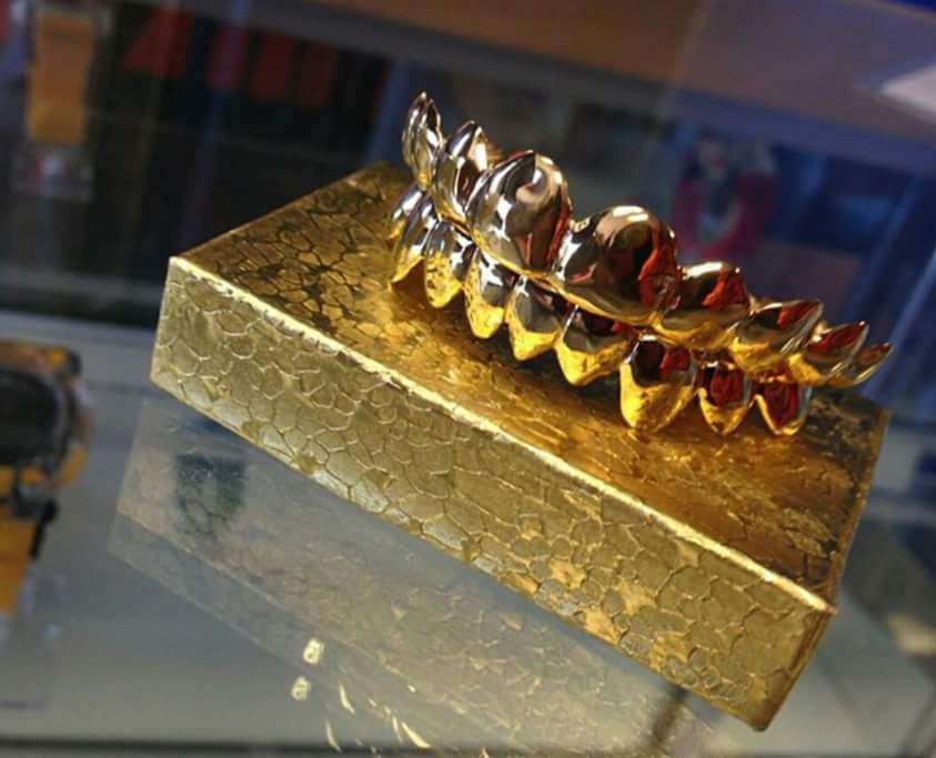 Gold Teeth Of San Antonio.. | San Antonio, TX 78225, USA | Phone: (979) 291-8055