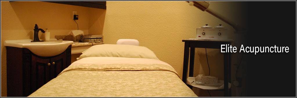 Elite Acupuncture | 3550 Bernal Ave #150, Pleasanton, CA 94566, USA | Phone: (925) 660-5535