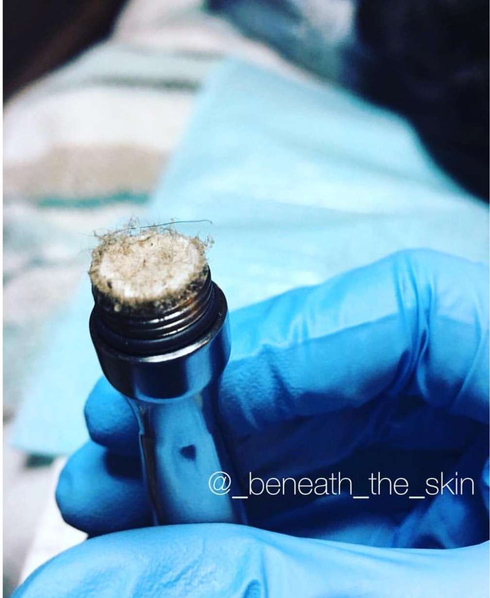 Beneath the Skin ~ Corrective Skincare Solutions | 8480 Baltimore National Pike #318, Ellicott City, MD 21043, USA | Phone: (301) 971-2769