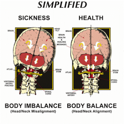 Chiro 1st Chiropractic | 11020 E 10th St, Indianapolis, IN 46229, USA | Phone: (317) 898-5800