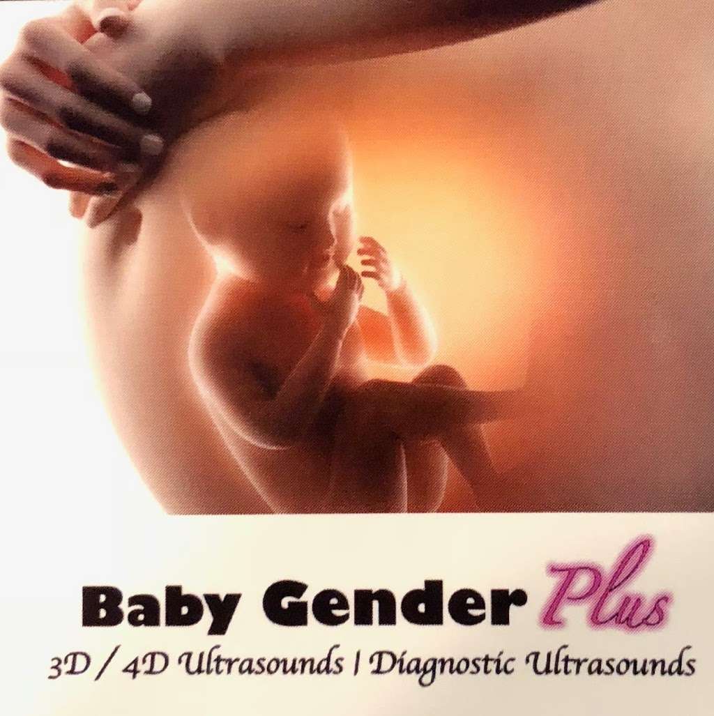 Baby Gender Plus | 388 W 80th Pl, Merrillville, IN 46410 | Phone: (219) 746-0915