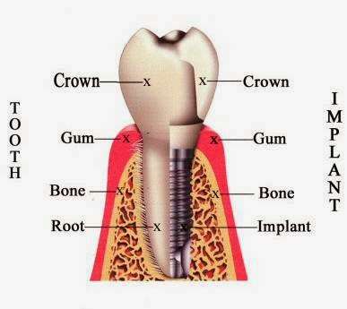 ALL COMFY DENTAL | 14649 Victory Blvd Suite # 20, Van Nuys, CA 91411, USA | Phone: (818) 387-8676