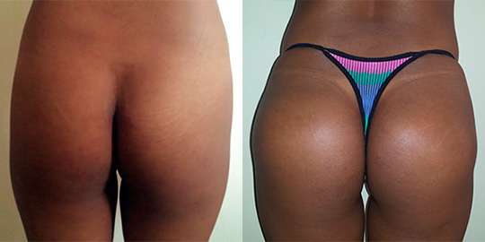 Siempre Bella MedSpa | 7414 Seville Ave, Huntington Park, CA 90255, USA | Phone: (323) 786-7296