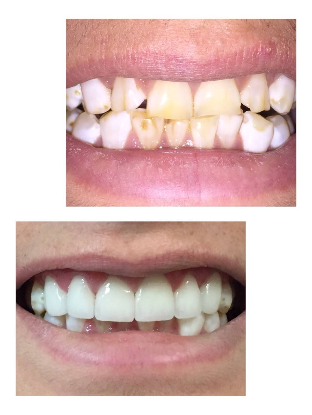 Crown Dental | 6300 White Ln # C, Bakersfield, CA 93309, USA | Phone: (661) 827-1100