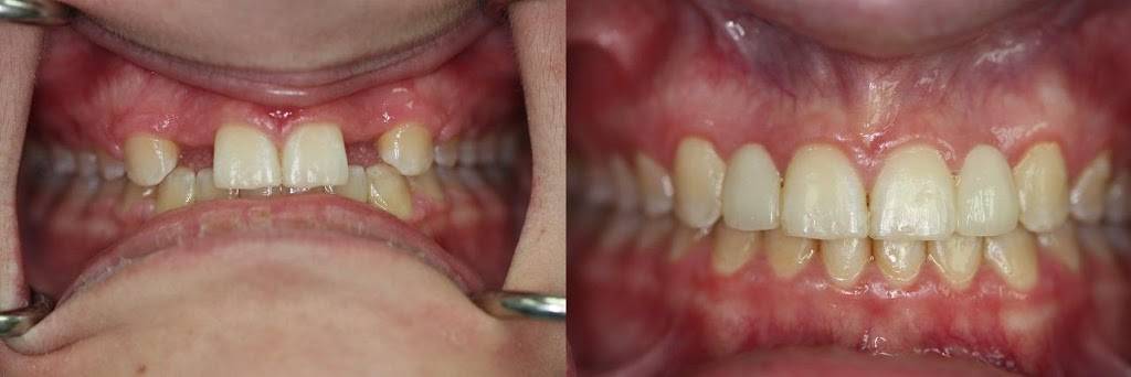 Malo Dental Prosthodontics | 2525 Embassy Dr #1, Hollywood, FL 33026, USA | Phone: (954) 430-3444