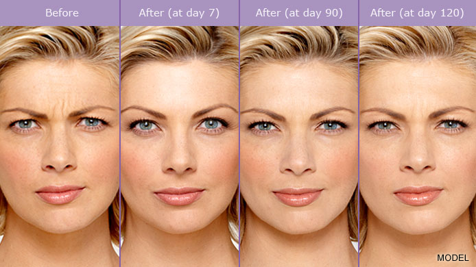 Brant Mozo DDS | 56 Ramtown-Greenville Rd, Howell, NJ 07731, USA | Phone: (732) 458-2288