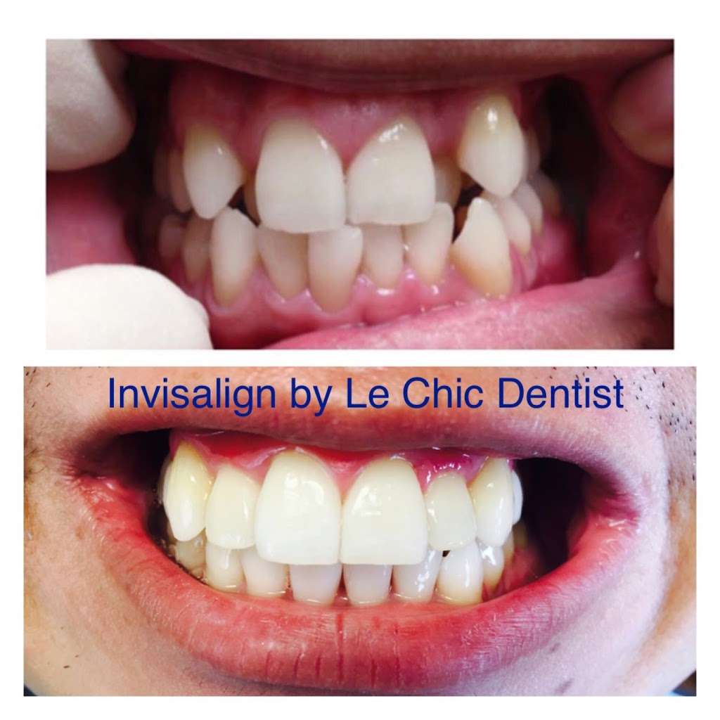 Le Chic Dentist | 3755 Sawtelle Blvd, Los Angeles, CA 90066, USA | Phone: (310) 398-5400