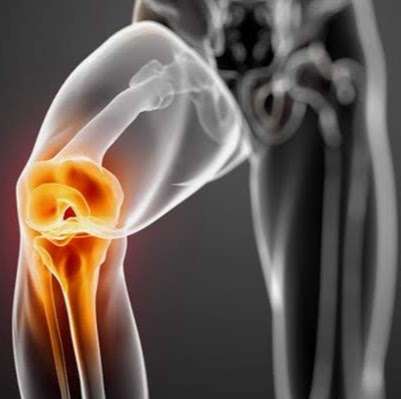 Arthritis Pain Management | 114-20 Rockaway Blvd suite 200, South Ozone Park, NY 11420, USA | Phone: (646) 647-8841