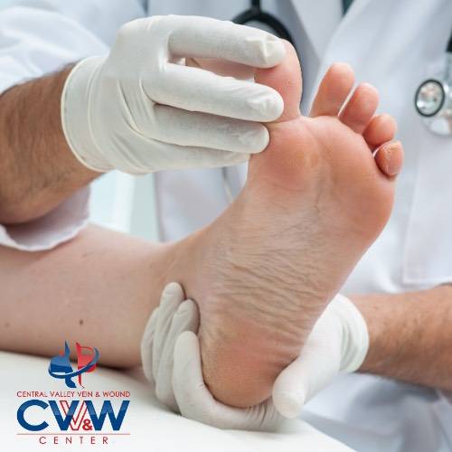 Central Valley Vein And Wound Center | 1850 Floral Ave, Selma, CA 93662 | Phone: (559) 721-4910