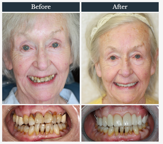 Harriman Family Dental | 96 NY-17M, Harriman, NY 10926, USA | Phone: (845) 783-6466