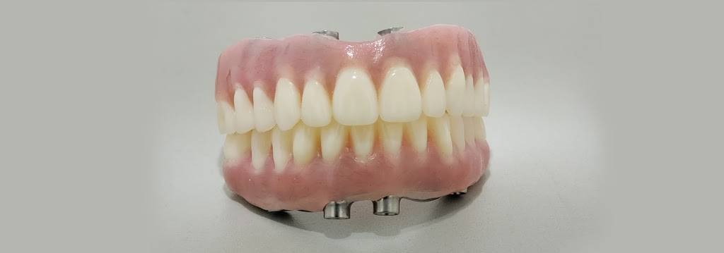 Custom Dental Prosthetics | 19155 SE McLoughlin Blvd #105, Gladstone, OR 97027, USA | Phone: (800) 595-3495