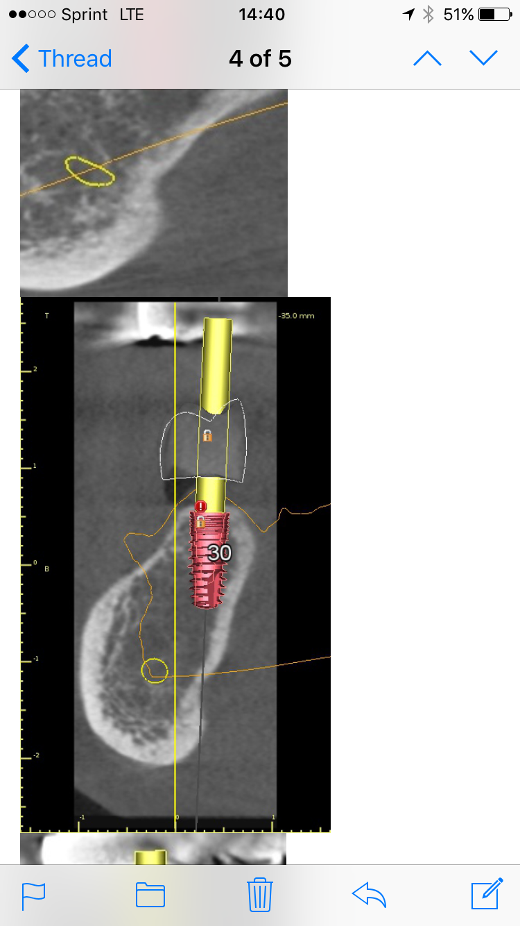 La Jolla Dental Implants and Periodontics | 521 Nautilus St, La Jolla, CA 92037, USA | Phone: (858) 454-4160