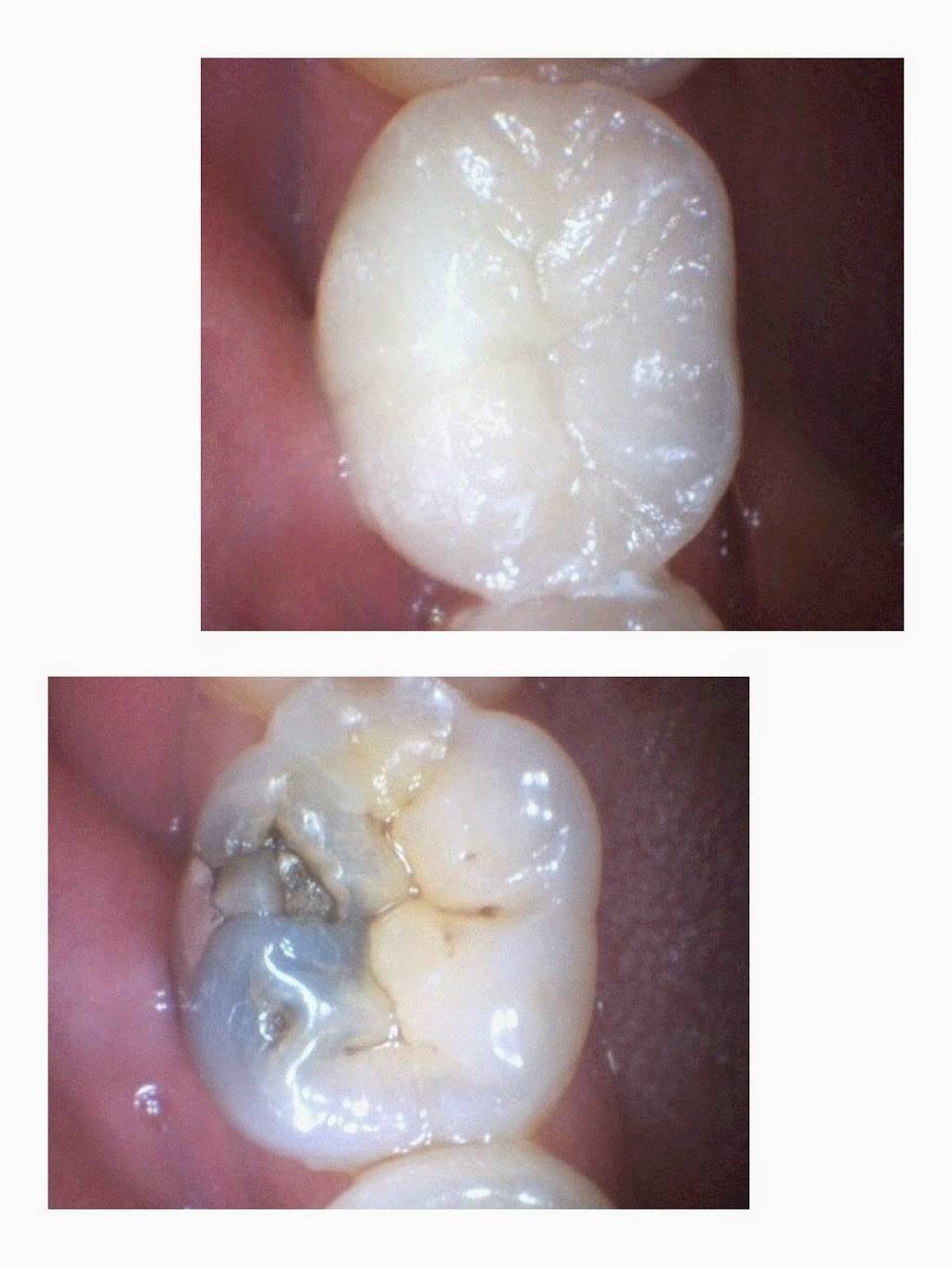 Crown Dental | 6300 White Ln # C, Bakersfield, CA 93309, USA | Phone: (661) 827-1100
