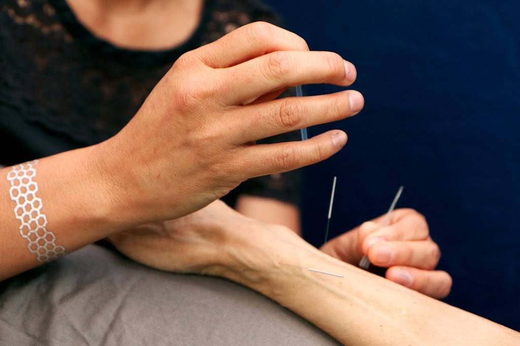 Berkeley Community Acupuncture | 2880 Sacramento St, Berkeley, CA 94702, USA | Phone: (510) 704-0593