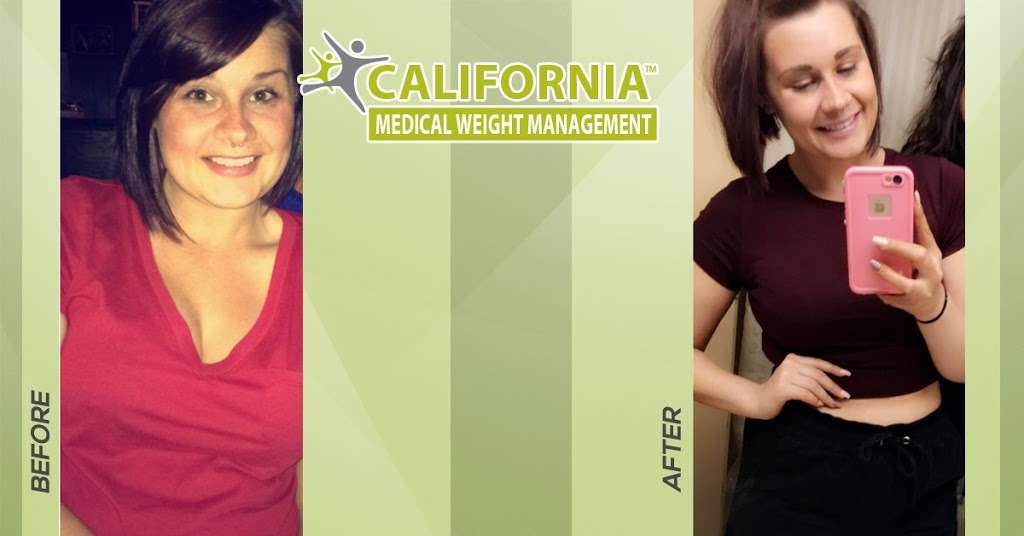 California Medical Weight Management - Scottsdale, AZ | 4845 E Thunderbird Rd, Scottsdale, AZ 85254, USA | Phone: (480) 771-0893