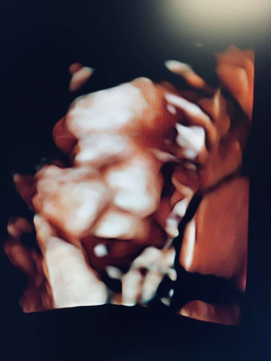 Love View 3D/4D Ultrasound Studio, LLC | 32222 Tamina Rd Suite A5, Magnolia, TX 77354, USA | Phone: (936) 524-9737